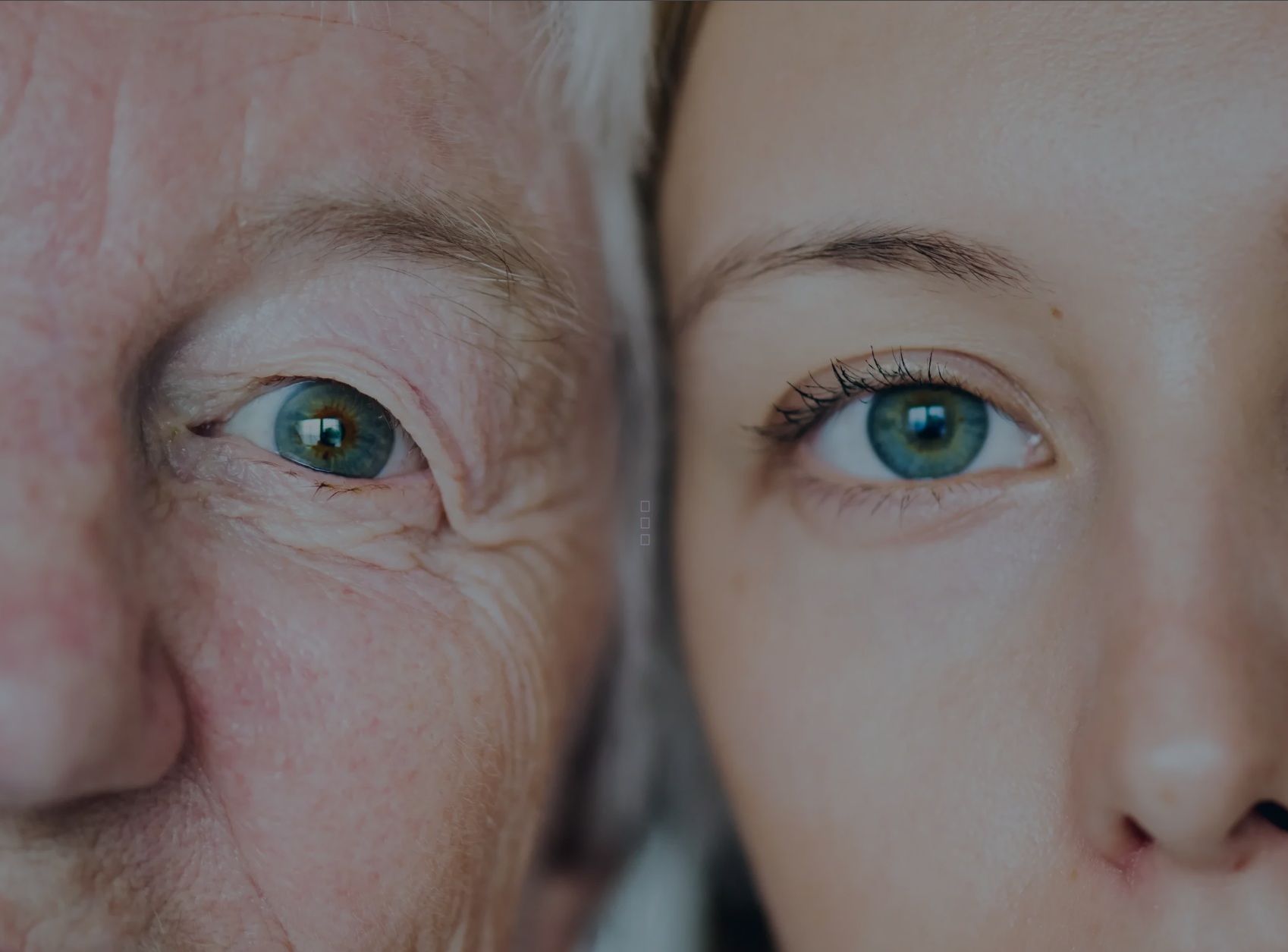 Paciente usando prótese ocular, sorrindo em primeiro plano